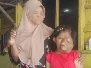 Mohon Bantuan Presiden RI Prabowo Subianto. Ibu & Anak Di Sragen Berjuang Melawan Kanker di Tengah Himpitan Ekonomi